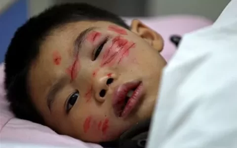 叫啥名字的人容易受伤_经常受伤的人是什么命